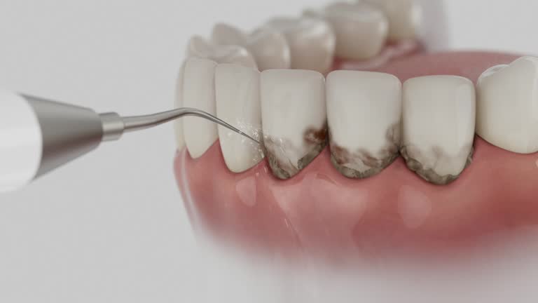 Reliable Dental contractor in Johnson City, NY by Dentist Open Now